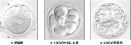 胚の分割