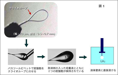 肺の凍結方法